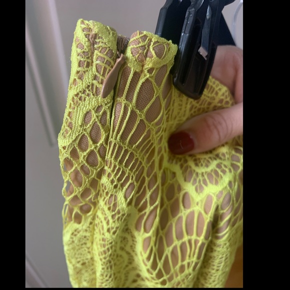 TOBI Greatest Escape Set - Picture 7 of 7